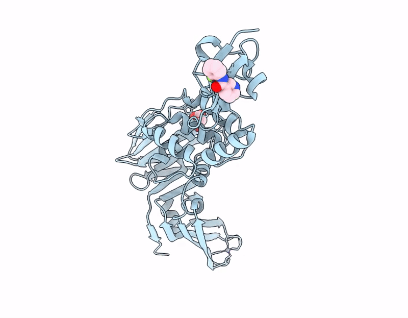 13MR image