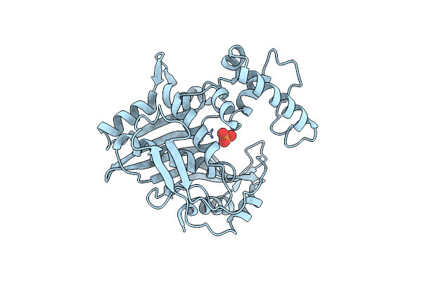 1TDA image