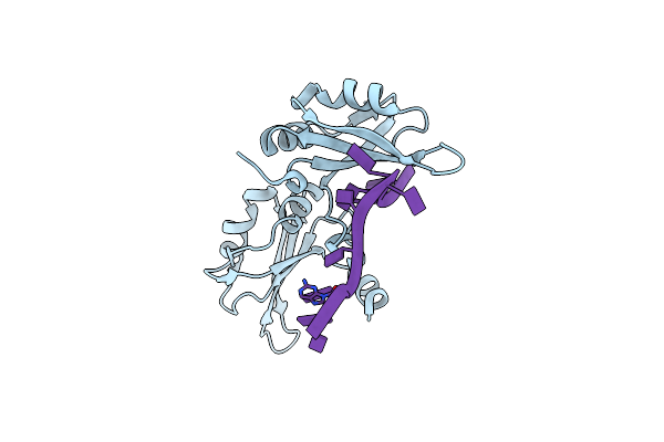 1U1P image