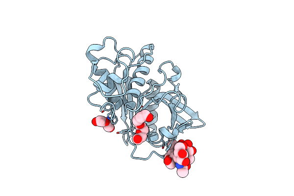2B1M image