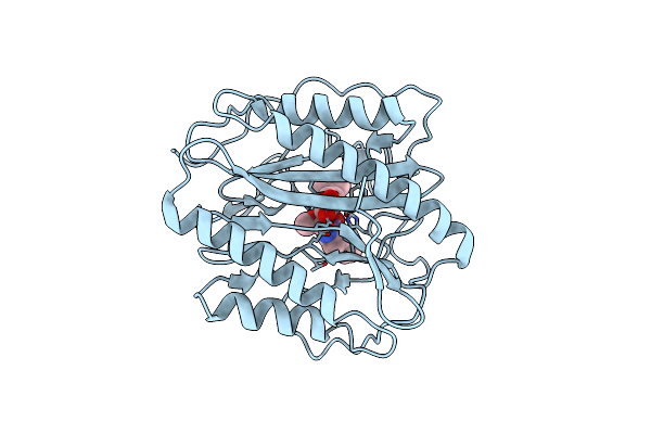 3PKD image