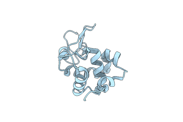 4ETB image