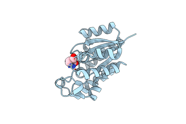 4S1P image