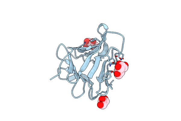 4TKC image
