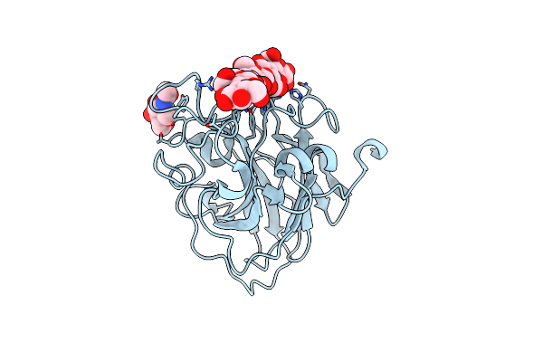 5ACI image