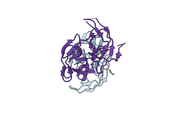 5T1V image