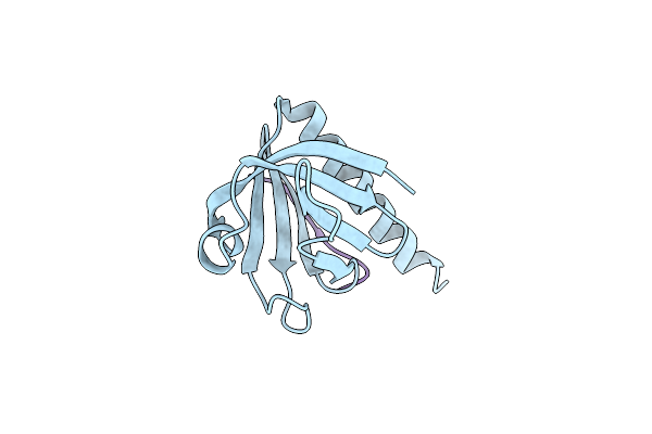 5U1M image